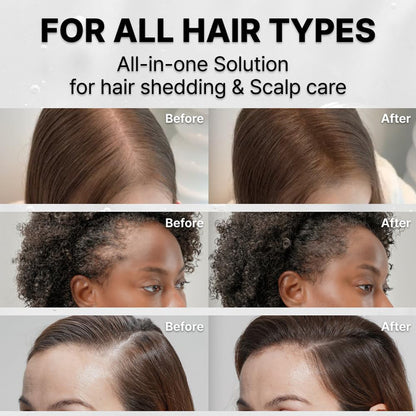 Hair Growth Serum with Built-In Brush Head for Massaging Hair and Improving Scalp