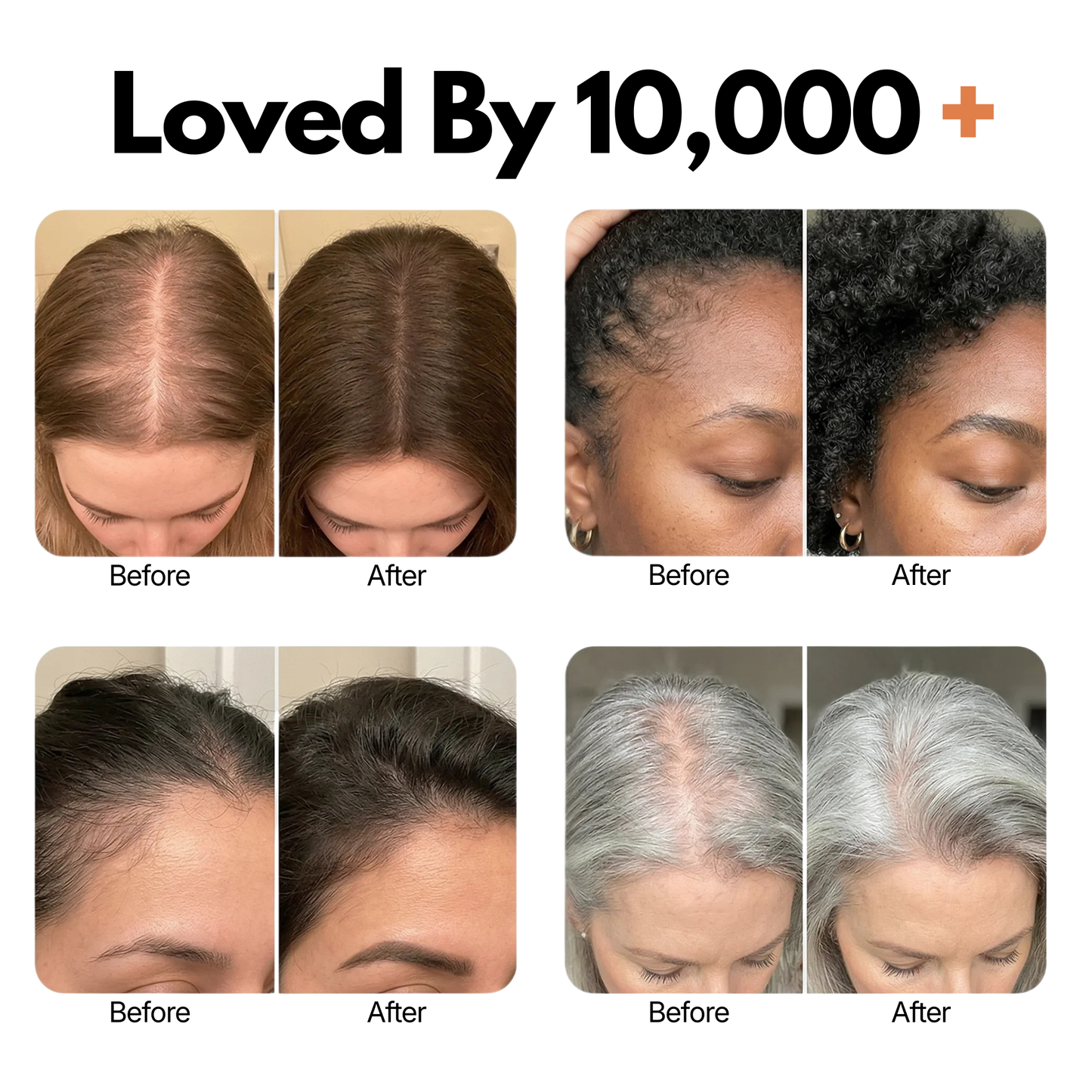 Scalpcair™ Korean Hair & Scalp Nourishing Serum