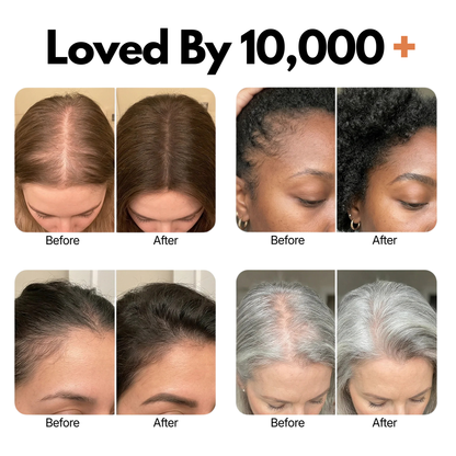 Scalpcair™ Korean Hair & Scalp Nourishing Serum